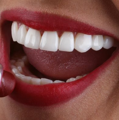 diseño de sonrisa mujer